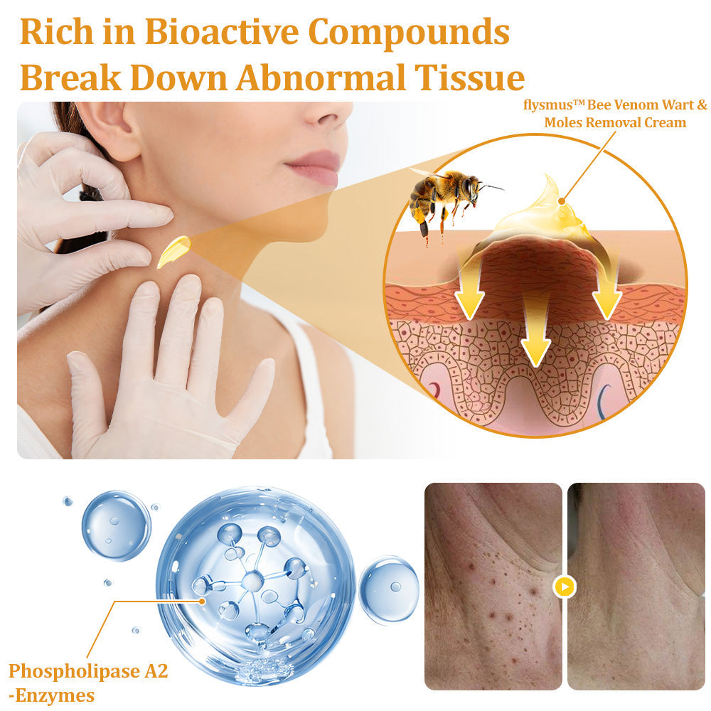 🐝 flysmus™ TagCure Bee Venom Skincare Cream, Certified by The British Association of Dermatologists (BAD) – Helps Treat Persistent Warts, Skin Tags, Skin Lesions, Infections, Scarring, and Smooth Uneven Skin 🌿👨⚕️