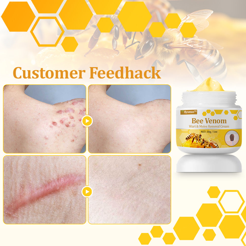 🐝 flysmus™ TagCure Bee Venom Skincare Cream, Certified by The British Association of Dermatologists (BAD) – Helps Treat Persistent Warts, Skin Tags, Skin Lesions, Infections, Scarring, and Smooth Uneven Skin 🌿👨⚕️