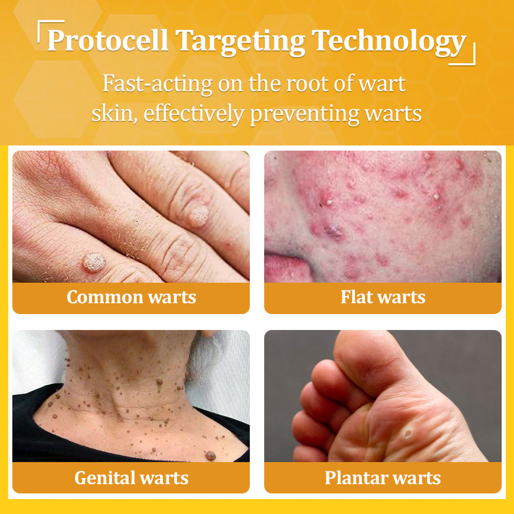 🐝 flysmus™ TagCure Bee Venom Skincare Cream, Certified by The British Association of Dermatologists (BAD) – Helps Treat Persistent Warts, Skin Tags, Skin Lesions, Infections, Scarring, and Smooth Uneven Skin 🌿👨⚕️
