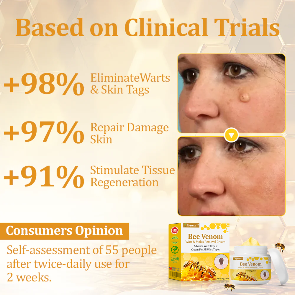 🐝 flysmus™ TagCure Bee Venom Skincare Cream, Certified by The British Association of Dermatologists (BAD) – Helps Treat Persistent Warts, Skin Tags, Skin Lesions, Infections, Scarring, and Smooth Uneven Skin 🌿👨⚕️