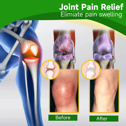 🍀👨‍⚕️Ourlyard™ Extra Strong Hemp Cream(Relieves joint pain and soothes soreness from muscle strains and sprains)